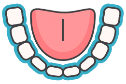 Invisalign